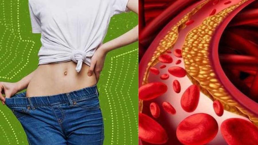 Có phải người béo mới bị mỡ máu còn người gầy thì không? Hóa ra rất nhiều người hiểu sai